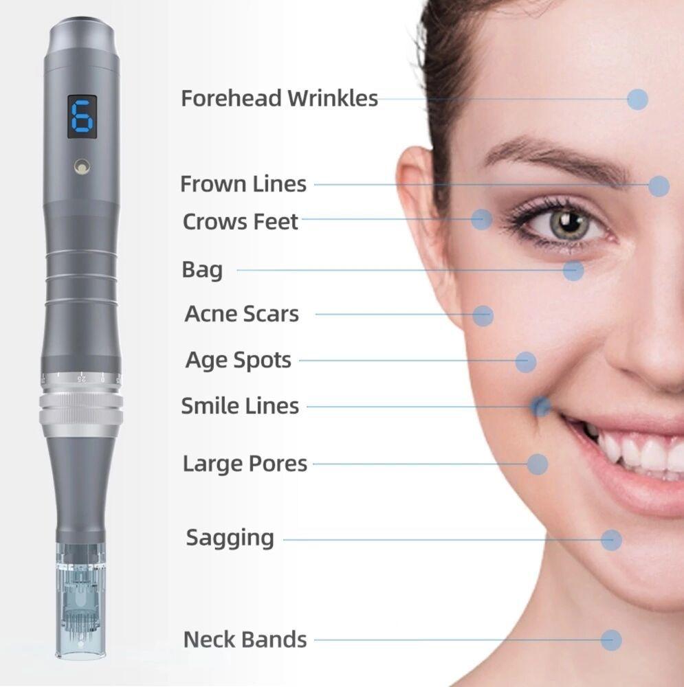 Dermapen Treatment Areas